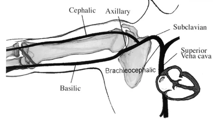 Fig 1. Upper limb veins used for cath-eter insertion and their relation to the