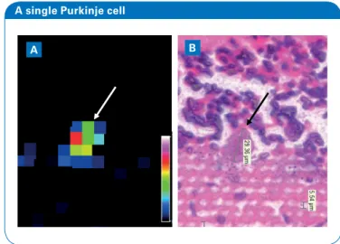 Figure 3: An example of a mass signal which is localized to the Pur- Pur-kinje cells. A: Wide-field view showing the distinctive cellular layer  surrounding the granular layer