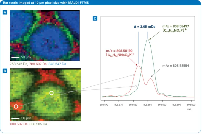 Figure 6: A: Image which shows three peaks localized to: tubule lumen (blue), basal layer (green) and interstitial space (red)
