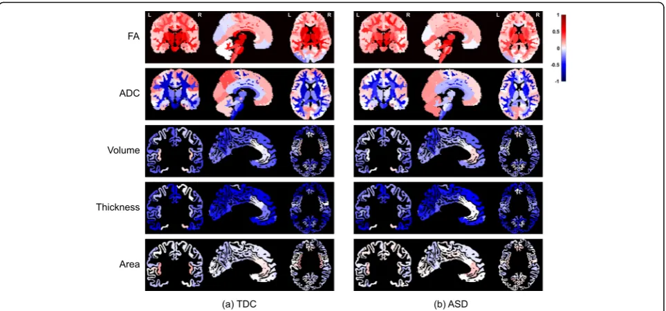 Fig. 3 The weights of the brain regions in age prediction within the TDC sample, usingADC) andsymptom severity
