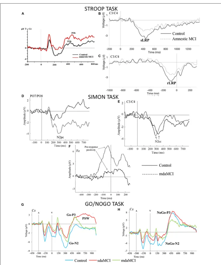 FIGURE 2 | Grand average Event-Related Brain Potentials (ERPs) waveforms elicited by (A) the incongruent stimuli in the Stroop task, (B,C) the response processing in the Stroop task [(B) the 0 ms point corresponds to the presentation of the stimulus, (C) t