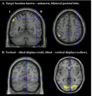 Fig. 5. A. Parietal activation associated with knowing target location, crosshairs at 47,p −50, 52