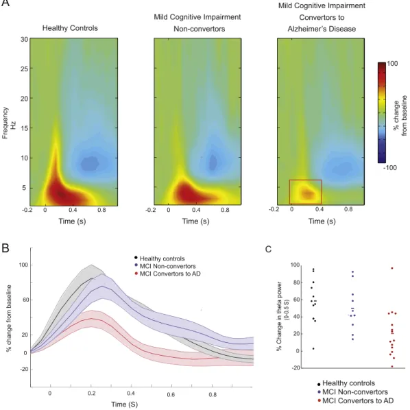 Fig. 1. An attenuation of theta activity associated with lexical processing of the target word in the group of MCI patients who would go on to convert to Alzheimer's disease