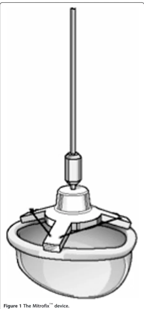 Figure 1 The Mitrofix™ device.