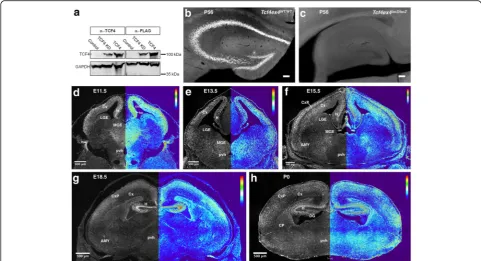 Fig. 1 TCF4 expression at different developmental stages and validation of antibody specificity.cortical plate; DG, dentate gyrus; H, hippocampal formation; hn, hippocampal neuroepithelium; LGE, lateral ganglionic eminence; MGE, medial ganglionic a Western