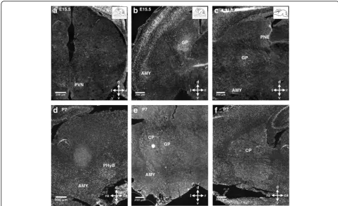Fig. 2 TCF4 expression in subcortical areas during neuronal development. TCF4 is expressed in developing hypothalamic nuclei (Abbreviations: AMY, amygdala; PHyB, basal peduncular hypothalamus; CP, caudoputamen; GP, globus pallidus; MGE, medial ganglionic e