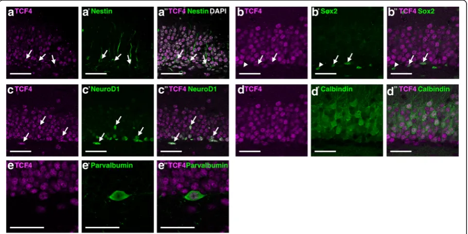 Fig. 7 TCF4 expression in different cell types in the adult dentate gyrus.partially expressed in Sox2-positive cells.mature neurons, and A–A” TCF4 is expressed in Nestin-positive radial glia-like cells