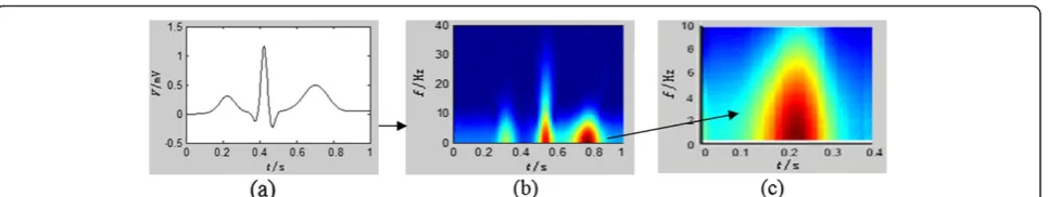 Figure 1 Time-frequency feature extraction of T wave. (a) a rhythm; (b) wavelet temporal-frequency figure of the rhythm (c) total energy ofthe T wave.