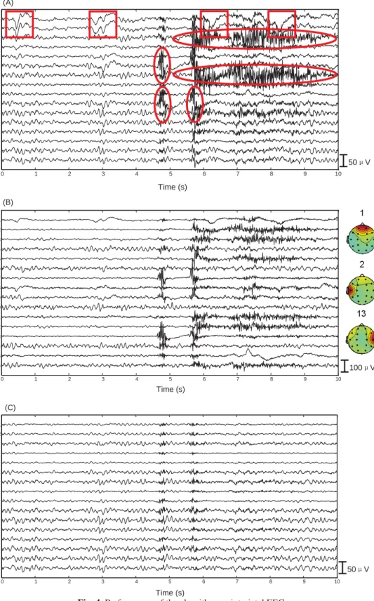 Fig. 4. Performance of the algorithm on interictal EEG  0 1 2 3 4 5 6 7 8  9 10   O2 O1 T6 P4 P3 T5 T4 C4 C3 T3 F8 F4 F3 F7 Fp2Fp1 50­VTime (s)(A) 0 1 2 3 4 5 6 7 8 910  16151413121110 9 8 7 6 5 4 3 2 1 100­VTime (s)(B) 0 1 2 3 4 5 6 7 8 910   O2 O1 T6 P4 