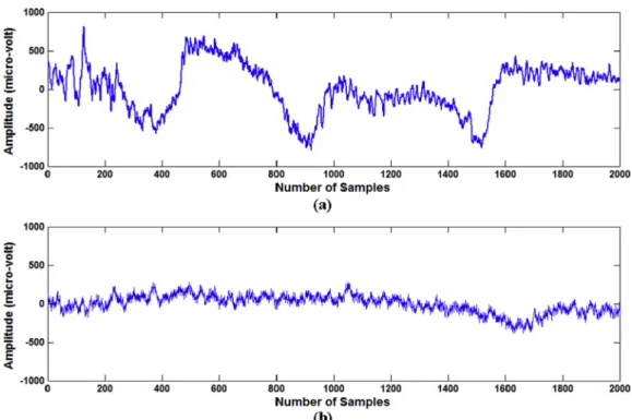 Figure 2 Histogram of normal and non-convulsive seizure EEG.
