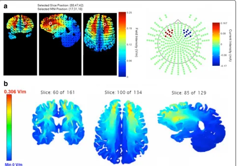 Fig. 4 a Simulation of 1.0 mA current flow with an F3 anodal-F4 cathodal montage from Soterix TDCS Explore