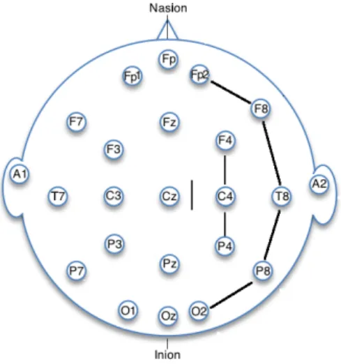 Figure 7. EEG electrodes Array, shows that the seizure starts in channel F8 and then spreads across the channels F8-T8-P8, F4-C4-P4