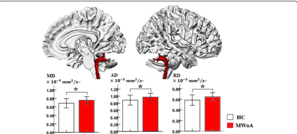 Fig. 3 Sagittal view of the spinal trigeminal nucleus (SpV) with significant differences in gray matter volume and diffusion characteristics betweenMWoAs and healthy controls