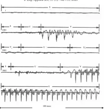 Fig. 2: Speech signal