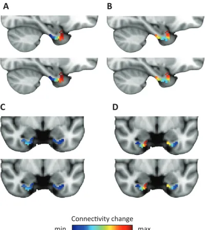FIGURE 4 | Dominant and second-dominant modes of functional connectivity change on the  basis of resting-state functional magnetic resonance imaging