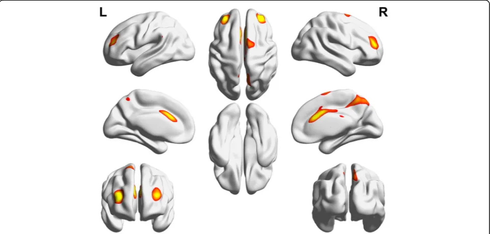 Fig. 2 Resting-state networks identified using independent component analysis. Nine automatically generated independent components (ICs)