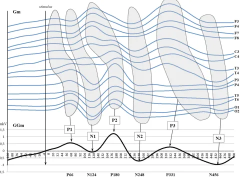 Figure 1. Schematic representation of EP components. GM - Great mean, GGM - General Great mean