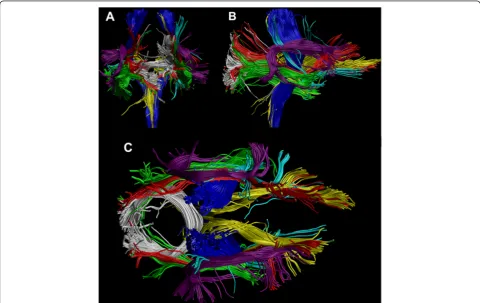 Figure 1 Coronal (A), sagittal (B) and axial (C) illustrations of the tracts used in the tract-level analysis