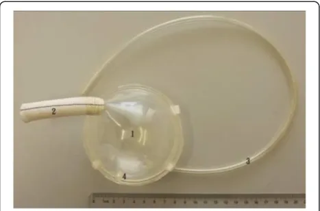 Fig. 1 Photograph of an extra-thorax paraaortic counterpulsationdevice (ETPACD). The ETPACD sac fills with 120-ml (a 65-mlstroke) blood volume (1) during ventricular systole and emptiesduring ventricular diastole through a single valveless cannula (2).The diaphragm is pneumatically driven by the console through agas line (3) and the gas outlet (4)