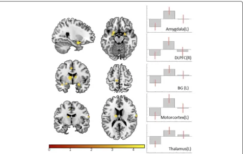 Table 3 Effect of tDCS on motor and visual processing