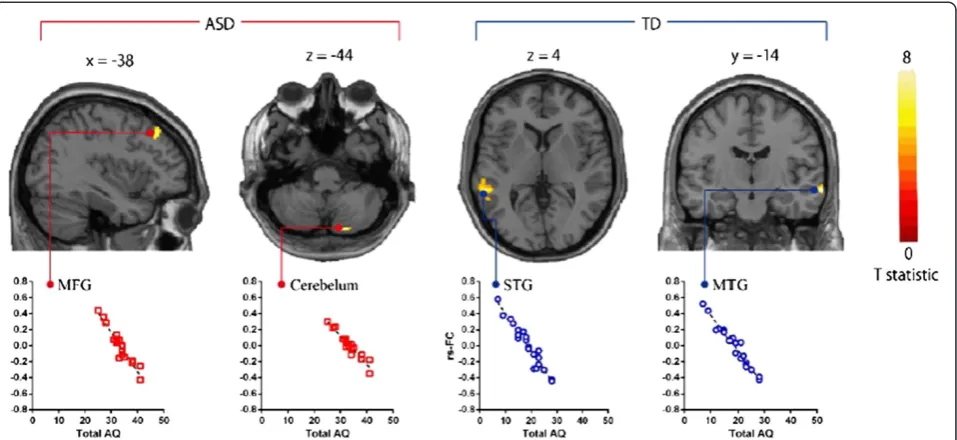Table 4 Brain regions showing correlations between age and the strength of rs-FCs in multiple regression analysis