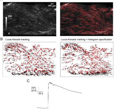 Figure 2.2: The motion of selected windows is tracked during a single contractionthe improvement in tracking when data is pre-processed using histogram specification, il-lustrated by an increased regularity of local tracks