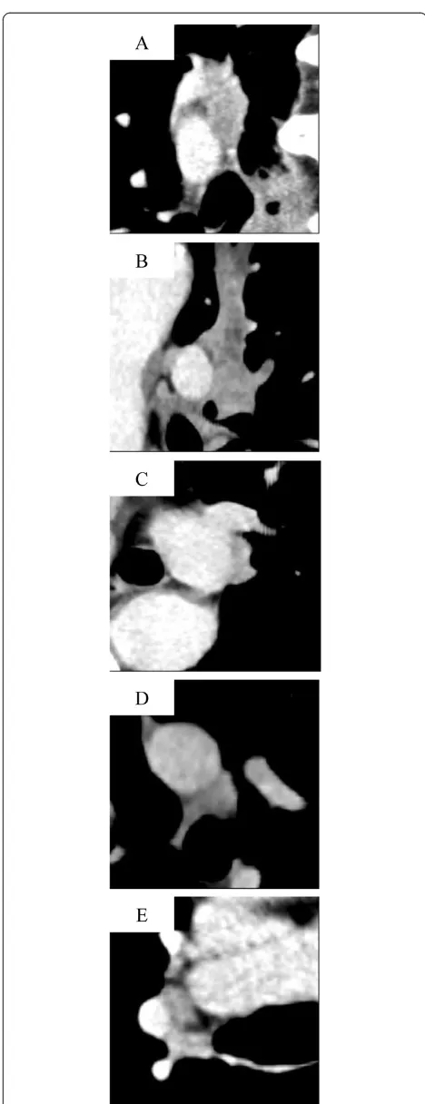 Fig. 3 One central slice shows the fat plane in series.c a case 1, b 2, 3, d 4, and e 5 in Table 2