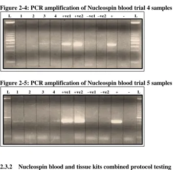 Figure 2-4: PCR amplification of Nucleospin blood trial 4 samples 