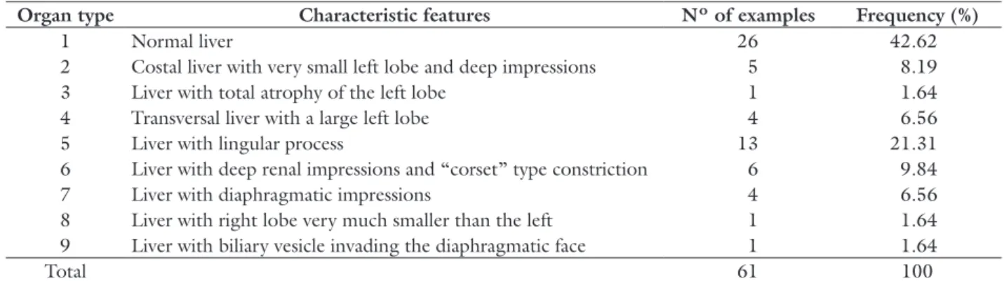 Figure 4. Type 3 liver with total atrophy of the left lobe.