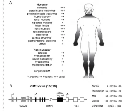 Figure  1  •  DM1  molecular  pathogenesis:  symptoms  and  locus.
