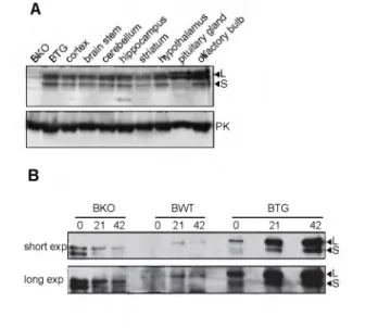 Figure  2  •  DMPK  protein  expression  in  brain  and  individual  brain  regions.