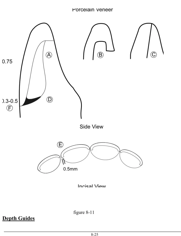 figure 8-11  Depth Guides