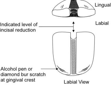 figure 8-15  Depth Cut in Grooves and Fossa 