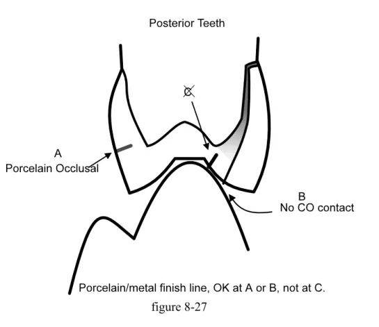 figure 8-27  Reducing the Labial/Buccal Surface  Introduction 
