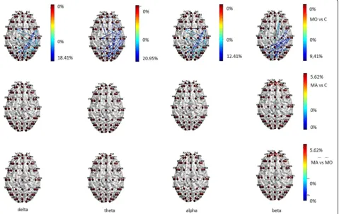 Fig. 1 Statistical differences in information transfer and their relative directions among nodes in resting state EEG bands are depicted in theMigraine with aura (MA), Migraine without aura (MO) and Controls (C) groups 