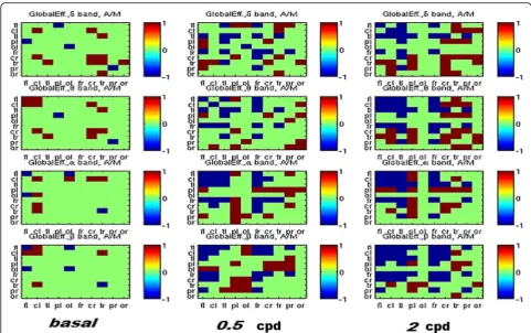 Fig. 7 Comparison of global efficiency in Migraine with aura (MA) and Migraine Without Aura populations: the matrix elements in red (+1)account for larger values in MWA, while those in blue (−1) account for larger values od MWoA
