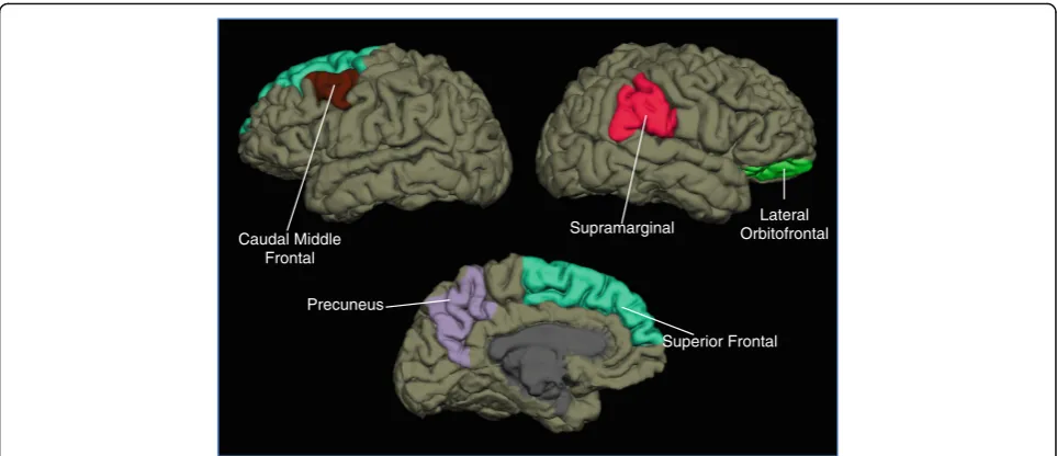 Table 3 Significance of each variable in the ANCOVA for brain region measurements that differed between PPTH and migraine