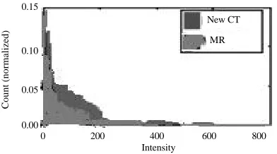 Fig. 6: Histogram of after pre-processing CT and MRI
