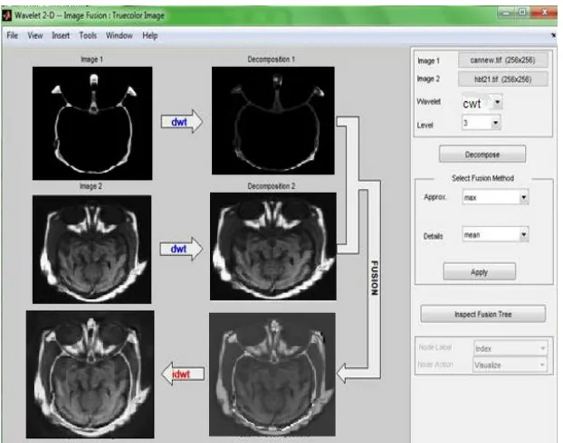 Fig. 12: GUI for image fused DT-CWT