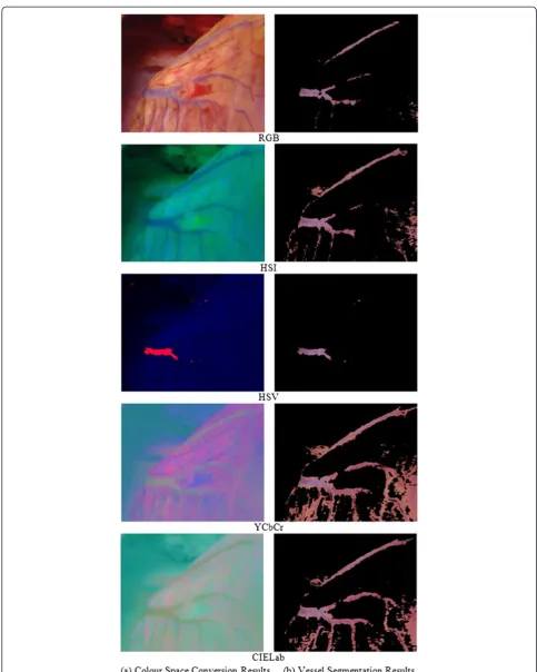 Figure 9 Results of vessel segmentation using different colour spaces. (a) Colour space conversion results