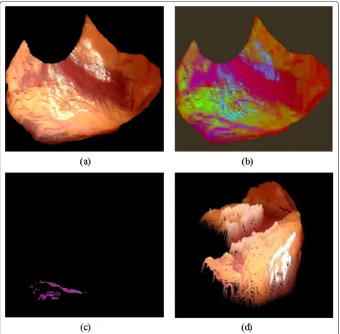 Figure 4 Vessels segmented by proposed segmentation mechanism and visualisation over the 3DHHM surface model