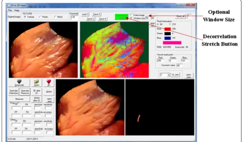 Figure 5 GUI design for vessel segmentation and 3D reconstruction processes.