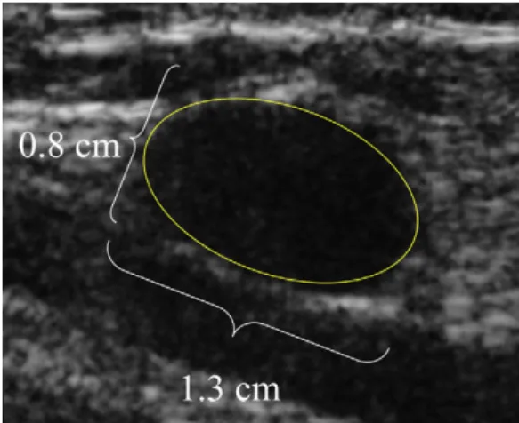Fig. 1. Normal axillary lymph node anatomy.