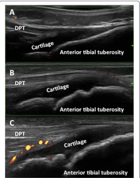 Fig. 5 Sonographic appearance of the patellar enthesis at differentages. a. 2 years old girl; b