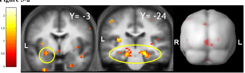 Figure 3-2  