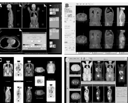 FIGURE 8. Samples of commercially available graphic user interface of  multimo-dality viewing software programs