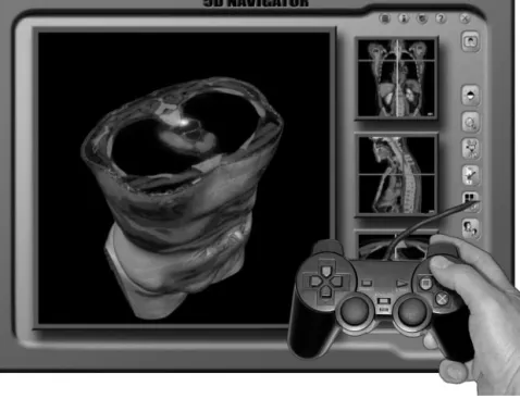 FIGURE 9. Artist’s view of enhanced multimodality image navigation program that would also use advanced joystick and interactive tool to navigate through  differ-ent dimensions of image data