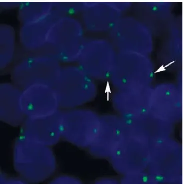 Figure 4. Staining with CEN-18 FITC-labeled PNA probe (green signals). Arrows  illustrate  the  localization  preference  close  to  the  membrane  of  gene-poor   DNA domains.