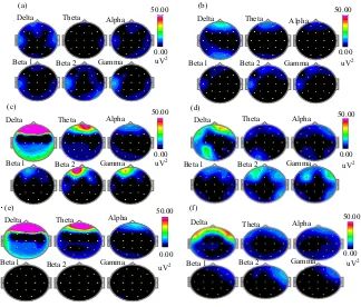 Fig. 9(a-f): Brain topography of all subjects for decision making task