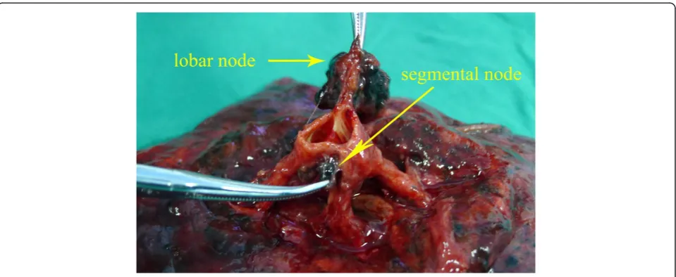 Figure 2 Lobar node and segmental node.